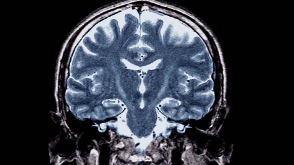 With Trump in office, an ALS cure seems farther than ever