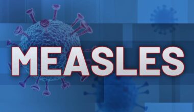 Potential measles exposure linked to eastern Iowa hotel
