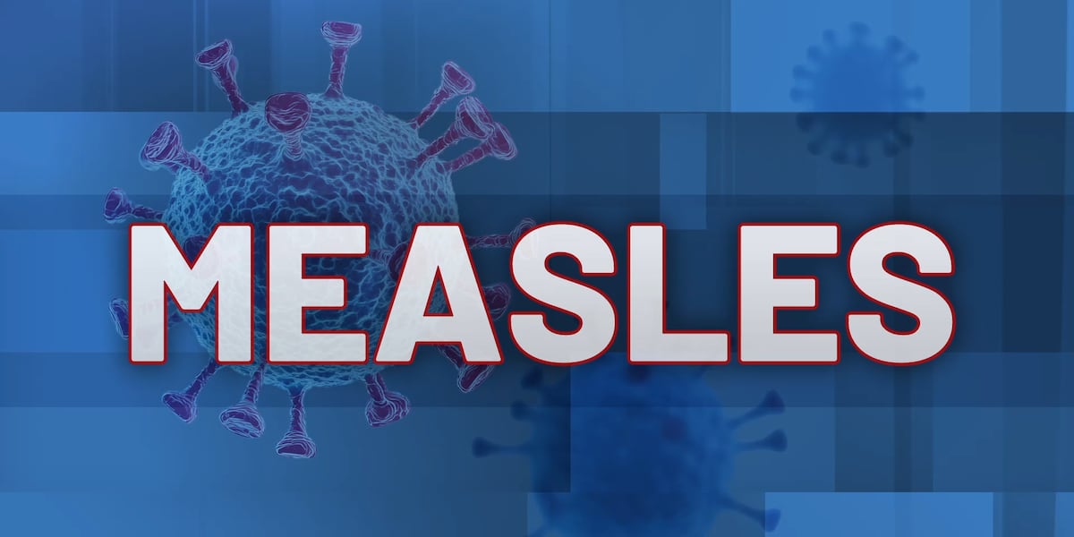 Potential measles exposure linked to eastern Iowa hotel