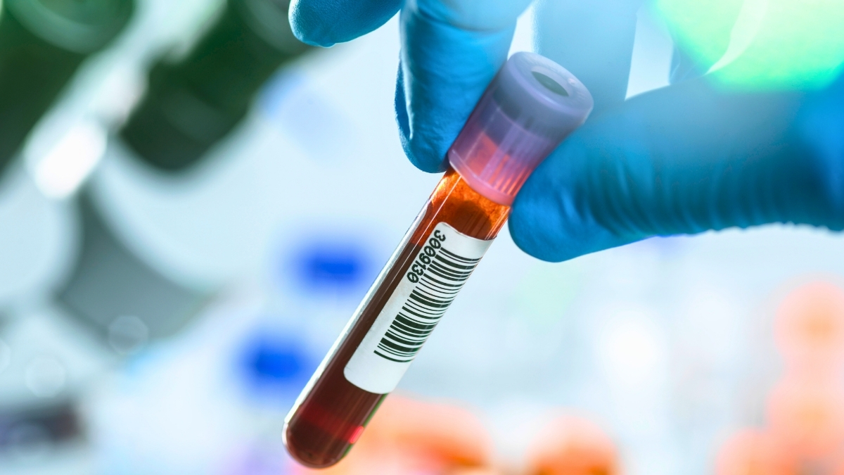 Blood Tests Could Revolutionize Early Cancer Detection – But There's a Catch : ScienceAlert