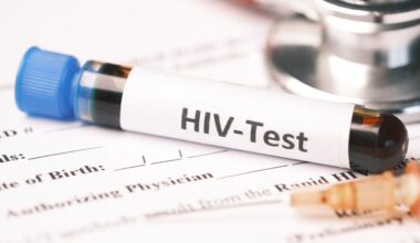 HIV test