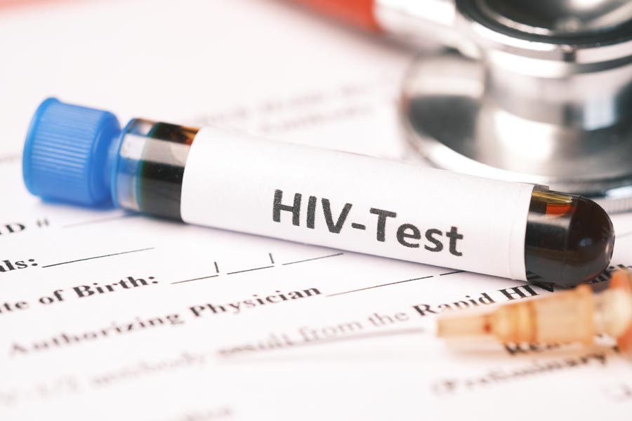 HIV test
