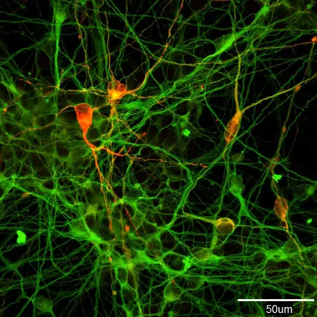 Human Ips Cell Derived Dopamine Producing Nerve Cells