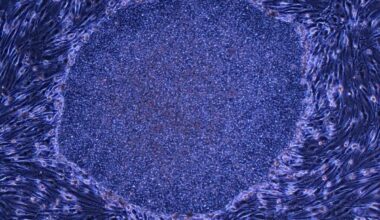 Japan’s New Ips Cell Therapies Push Regenerative Medicine Into A New Phase