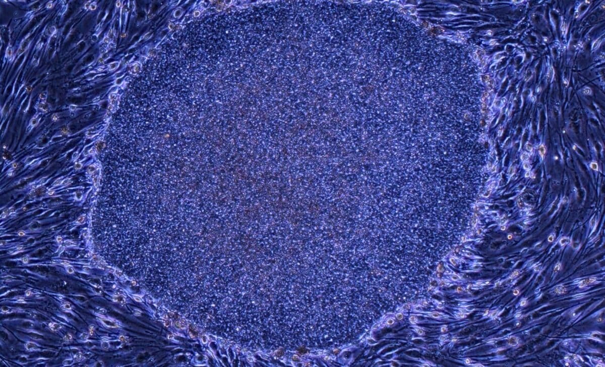 Japan’s New Ips Cell Therapies Push Regenerative Medicine Into A New Phase