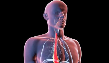 An illustration of a human body, with the outer layers transparent and the esophagus a bright red.