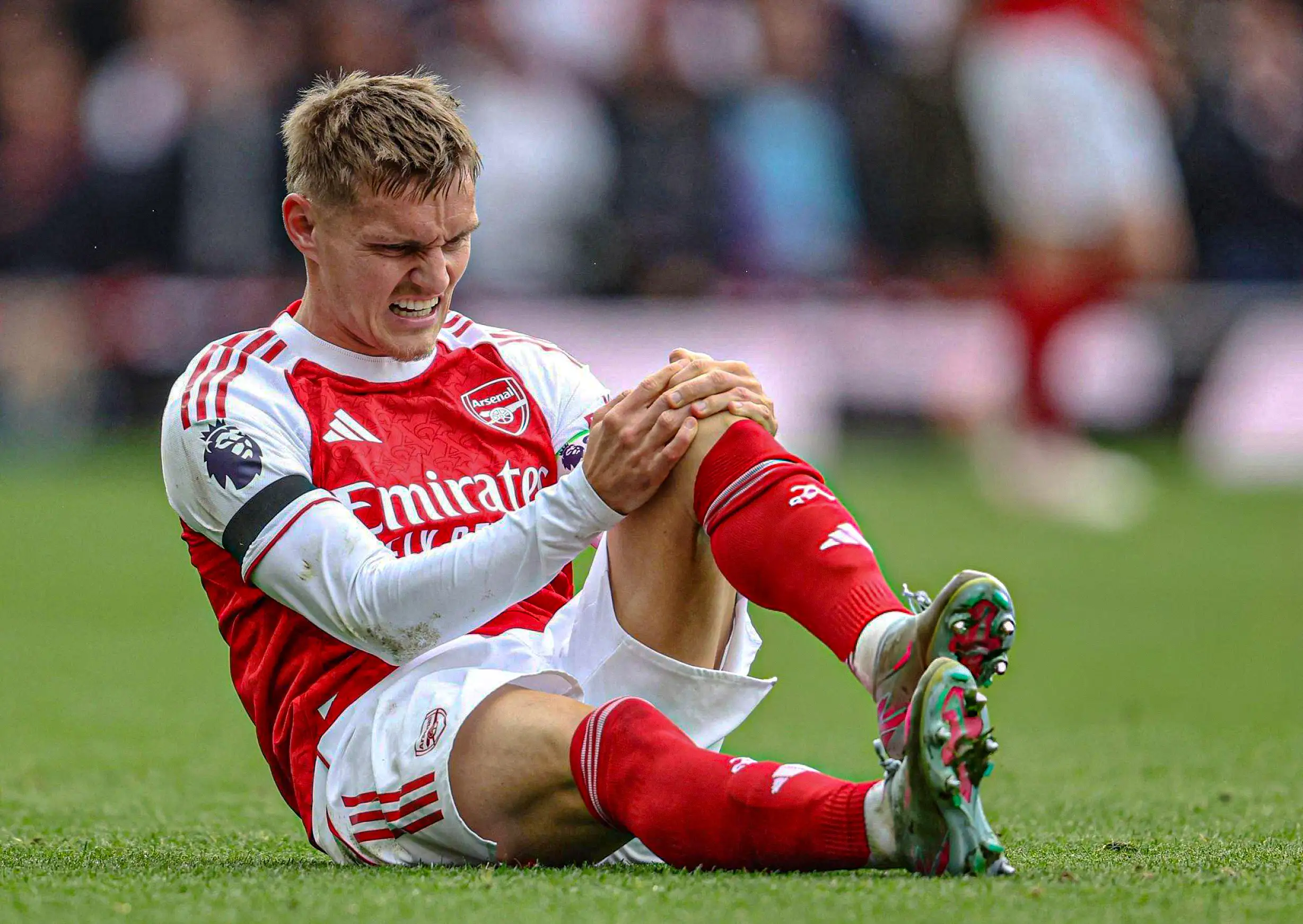 Arsenal Martin Odegaard knee injury