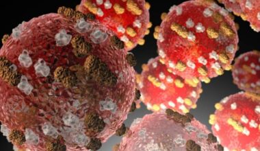 Measles exposure possible from several Big Island locations because of infected visitor : Big Island Now