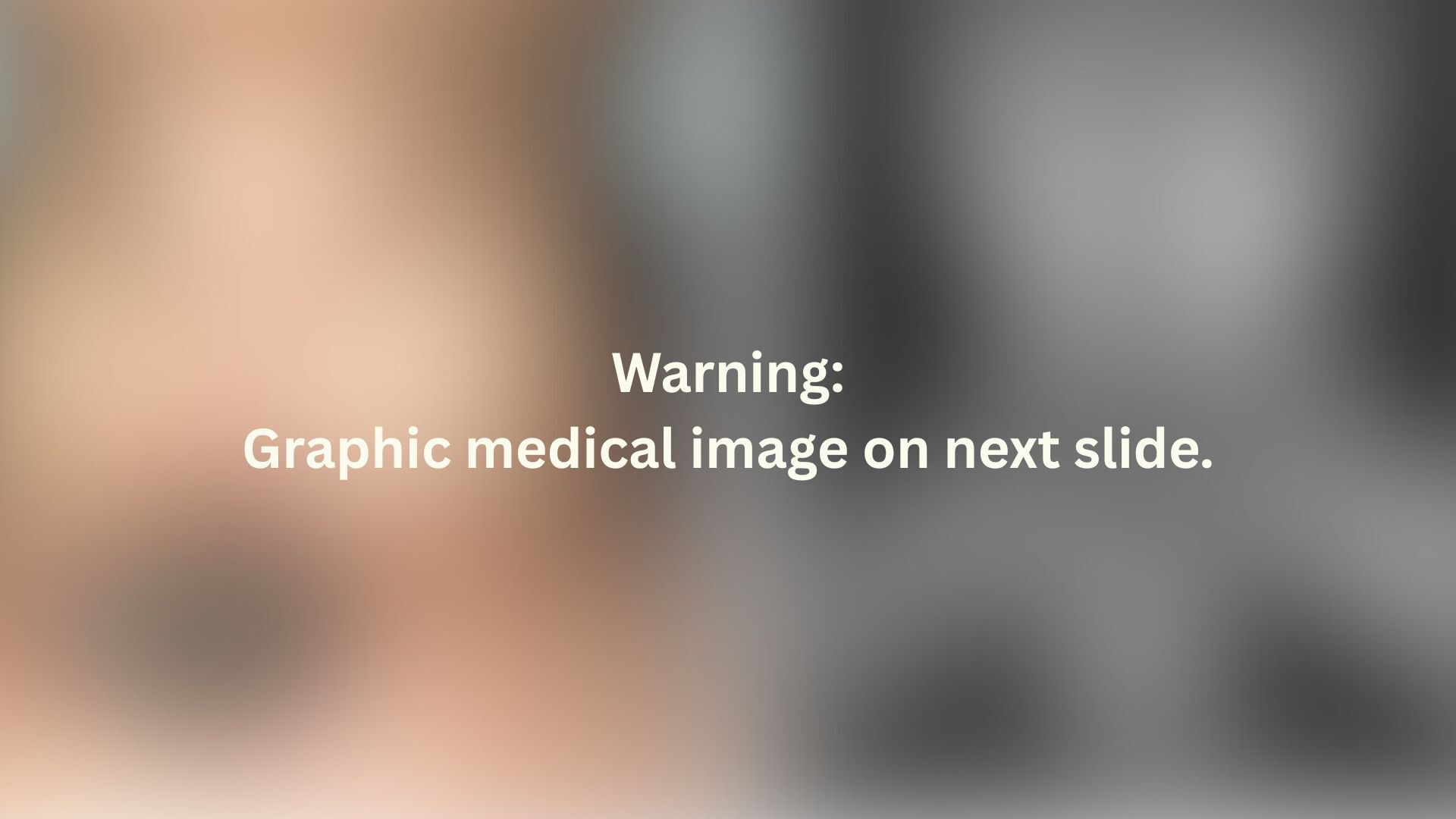 Warning slide reading 