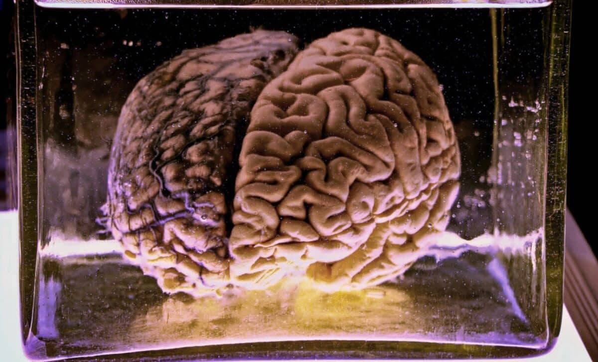 Scientists Shut Down Brain Activity At −150 °c For 7 Days Then Measured What Came Back After Warming