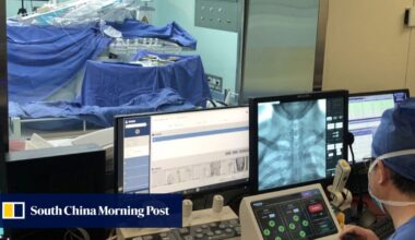 Chinese surgery robot outperforms humans, cuts brain imaging time by 29%