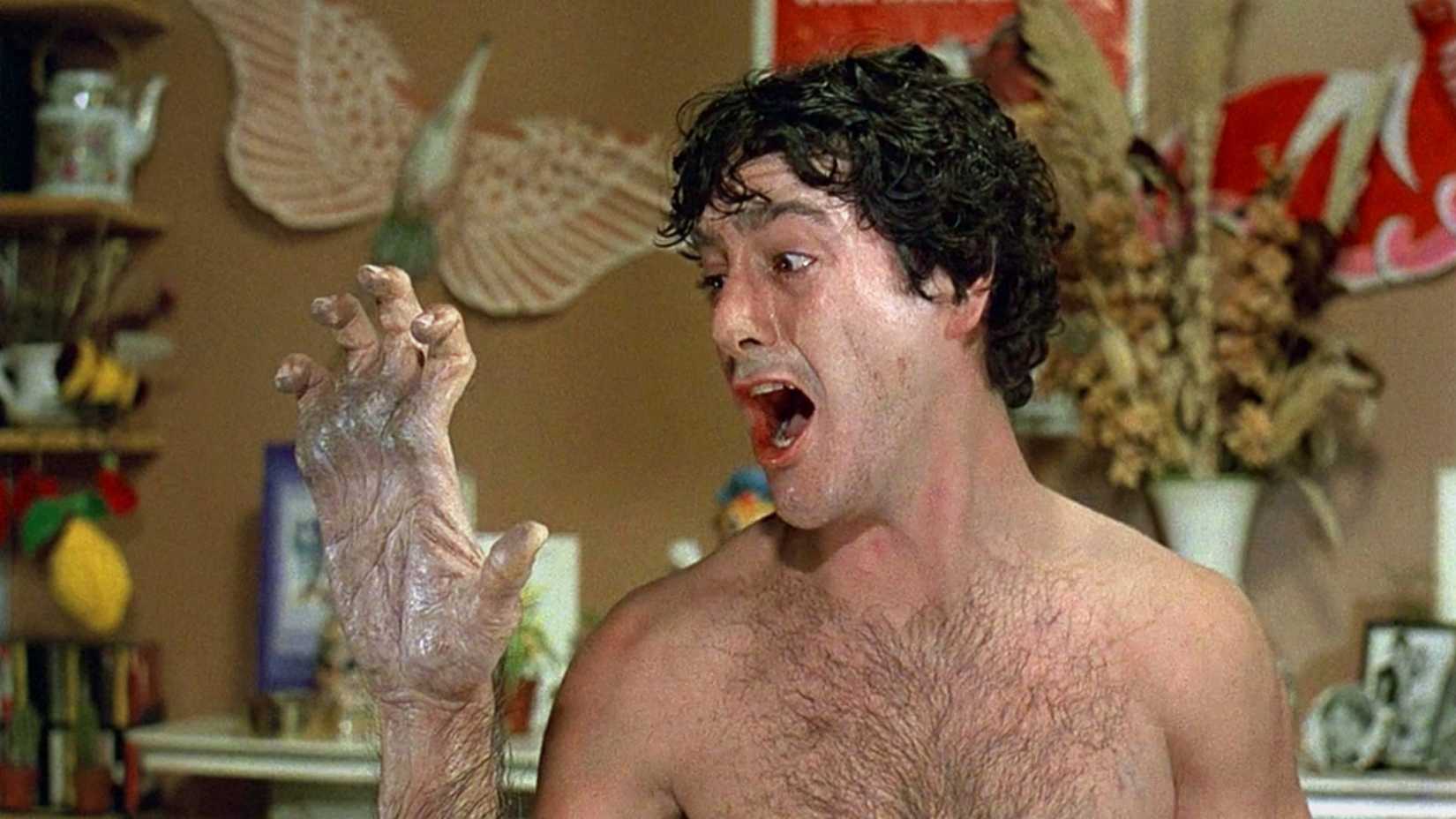 David screams as his hand transforms in An American Werewolf in London