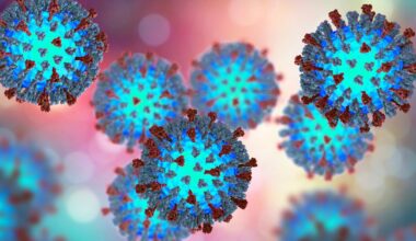 Health officials warn of potential measles exposure at a Westerville CVS