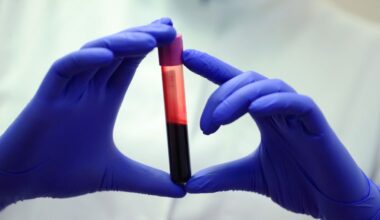 Rising CO2 Could Be Altering Our Blood Chemistry, Study Suggests : ScienceAlert