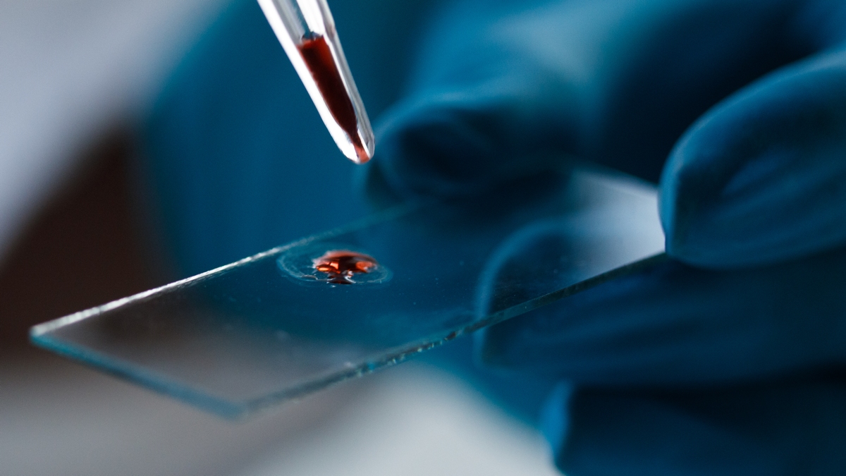 Simple Blood Test Can Predict Dementia Risk in Women Decades Before Symptoms : ScienceAlert