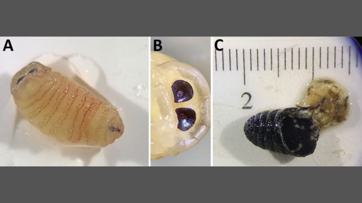 Woman Gets Infested by Maggots, Sneezes Them Out