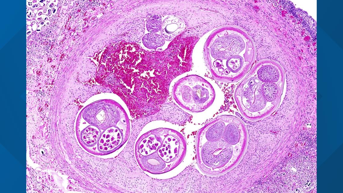 Brain-infecting worms, known as 'rat lungworm,' detected in San Diego County