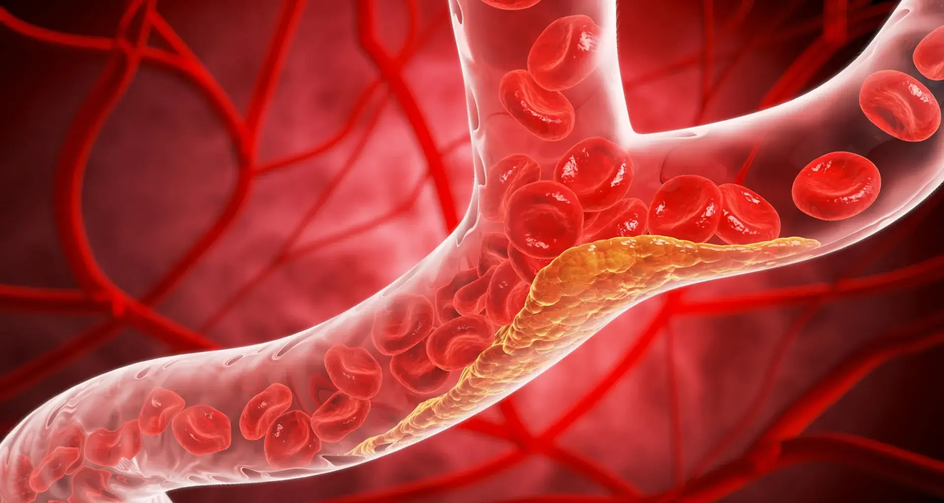 New cholesterol guidelines could change when you get tested