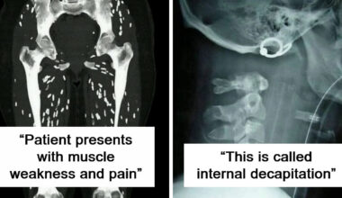 “Man Struck By Lightning”: 41 Rare Medical Photos That May Feel Gross But Are Deeply Fascinating