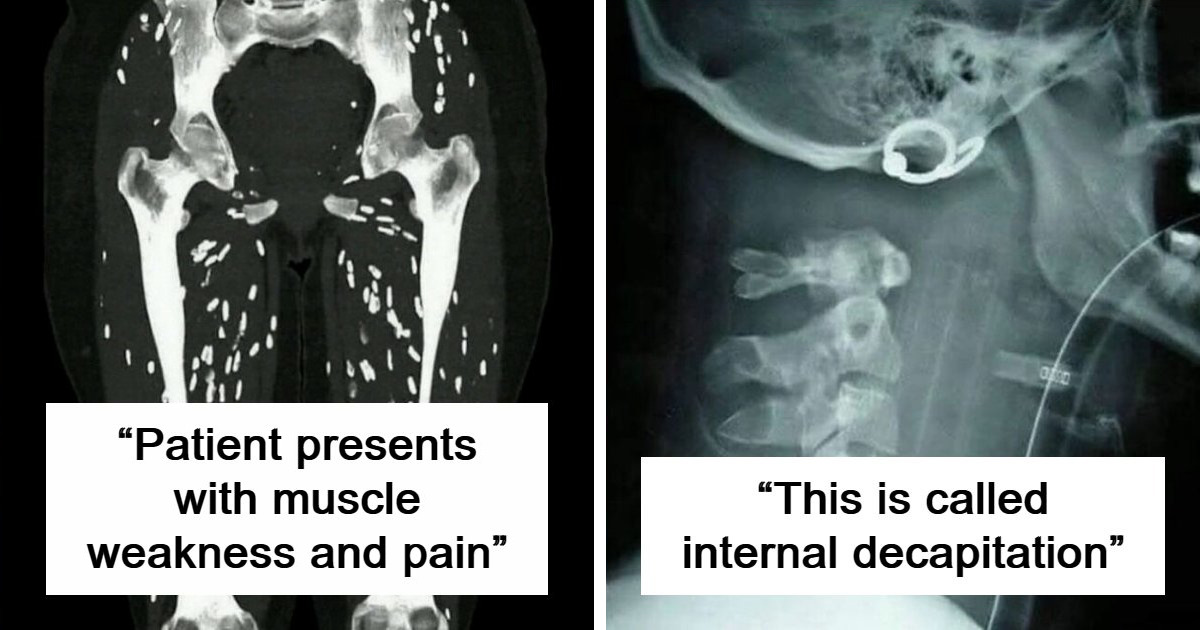 “Man Struck By Lightning”: 41 Rare Medical Photos That May Feel Gross But Are Deeply Fascinating