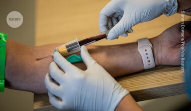 Cancer blood tests are everywhere. Do they really work?