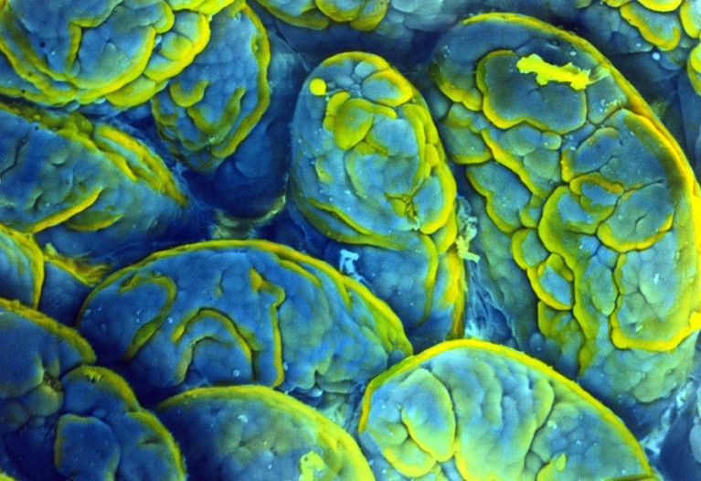 Scanning electron micrograph of the lining of the ileum in the small intestine, showing the villi, that resemble textured grains of rice.