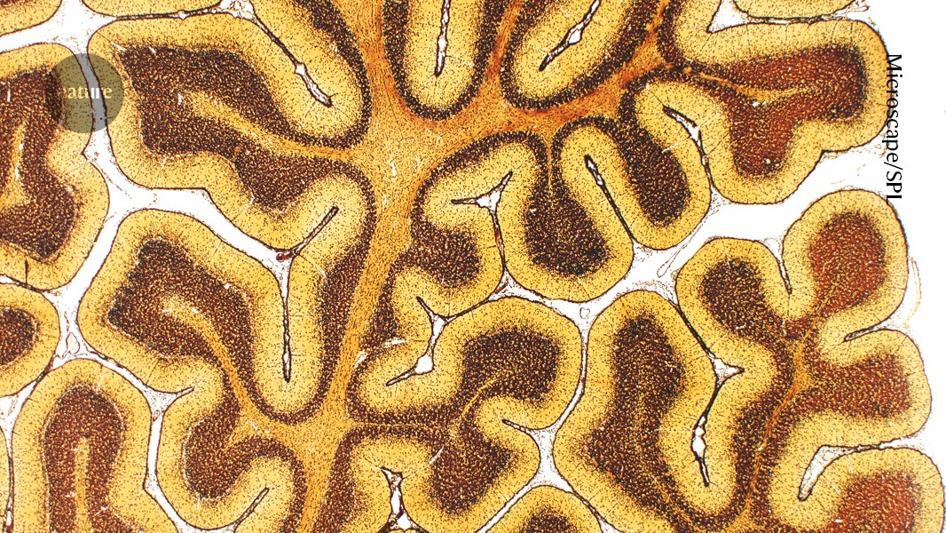 First atlas of brain organization shows development over a lifetime