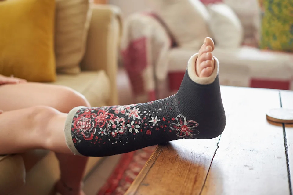 A person's foot in a decorative cast with floral designs rests on a wooden table