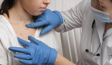 We study pandemics, and the resurgence of measles is a grim sign of what’s coming