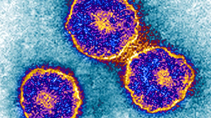 Measles is not the only disease on the rise. Mumps also may be making a comeback