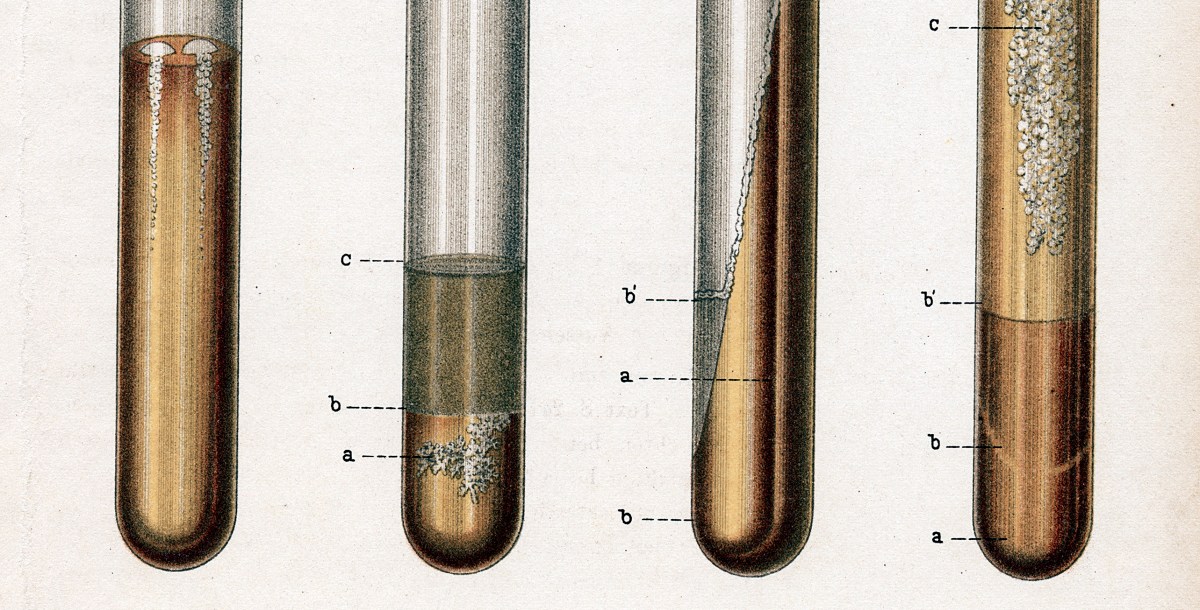 The world’s deadliest infectious disease is on the rise in the US