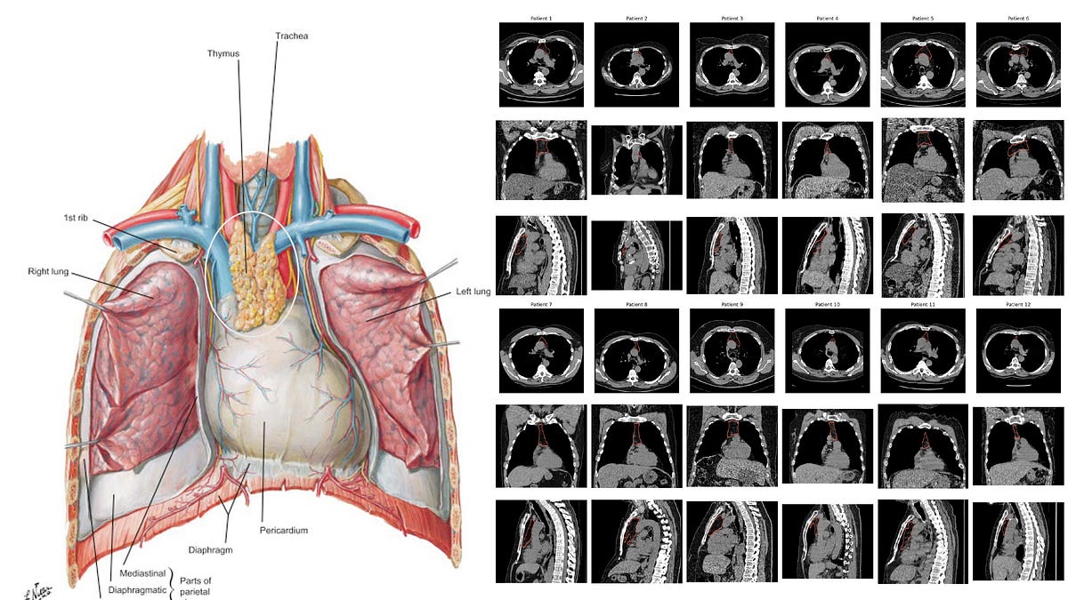 Your Thymus and Your Healthspan
