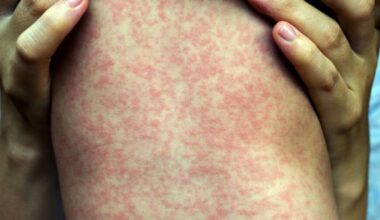 (Phichet Chaiyabin, Shutterstock)...