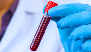 The Blood of Centenarians Reveals 37 Proteins Linked With Slower Aging : ScienceAlert