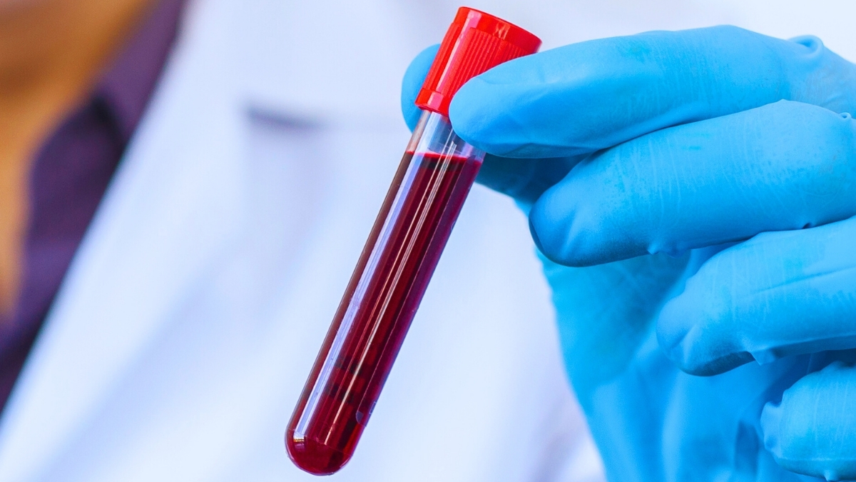 The Blood of Centenarians Reveals 37 Proteins Linked With Slower Aging : ScienceAlert