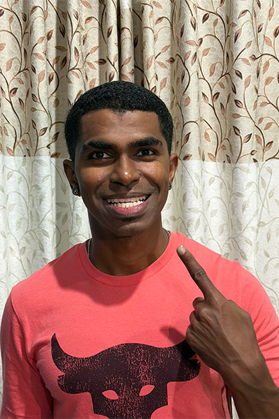 Prathab pointing to his teeth