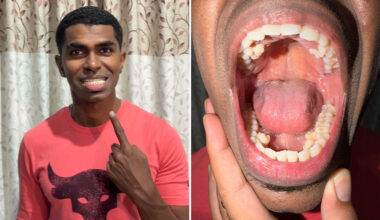 split image of Prathab smiling and with his mouth open