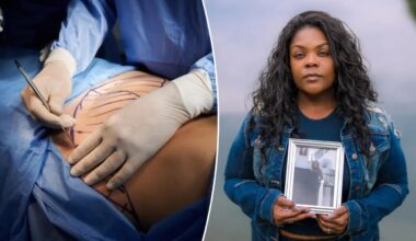 Cosmetic surgery chains under fire amid disfiguring injuries, deaths