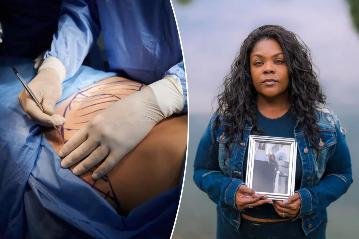 Cosmetic surgery chains under fire amid disfiguring injuries, deaths