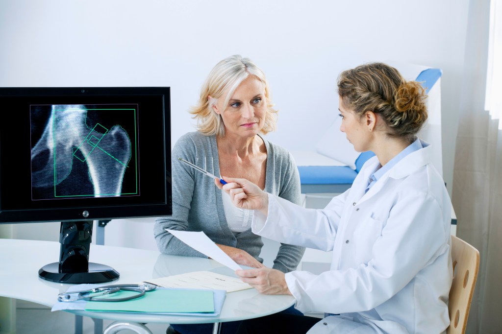 A medical professional consults with a senior female patient about a hip bone density scan showing osteoporosis