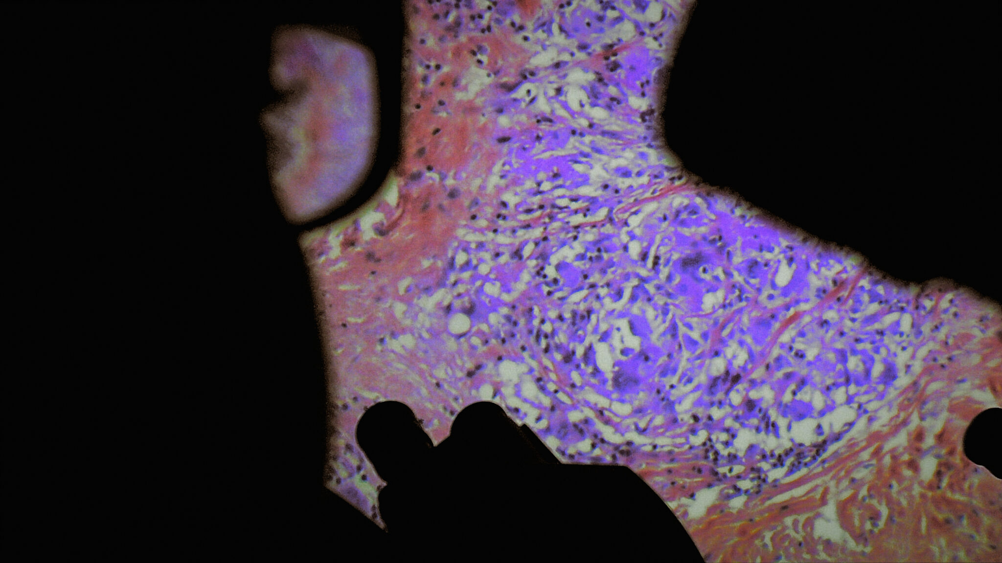Véréna Paravel and Lucien Castaing-Taylor, “De Humani Corporis Fabrica,“ 2022. Multi-channel video installation