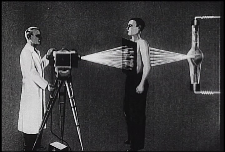 “Moving X rays,” c. 1938, prod. by Nicholas Kaufmann. Written and directed by Martin Rikli, technical advisor Robert Janker. Digital video