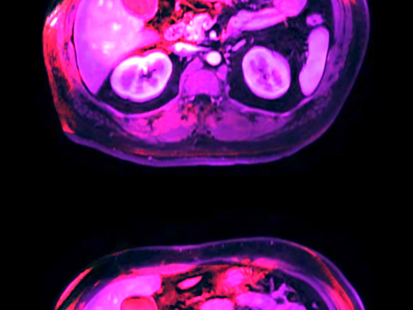 Anna Kipervaser, “in ocula oculorum,” 2021. Digital video