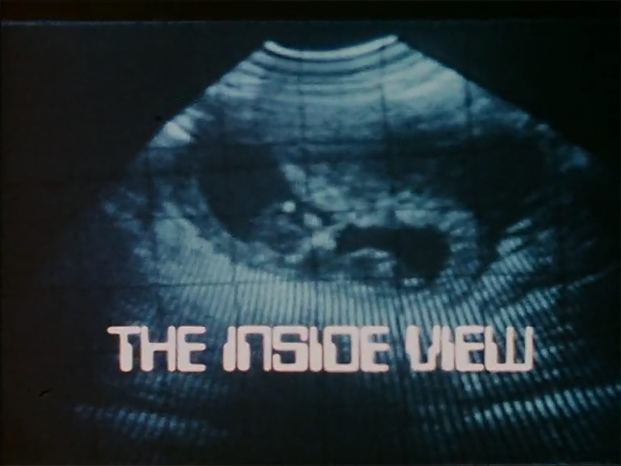 London Television Service, “The Inside View,” 1979, dir. by Edward Poulter