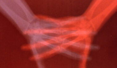 Exploring How Much Art, Technology, and the Body Intersect