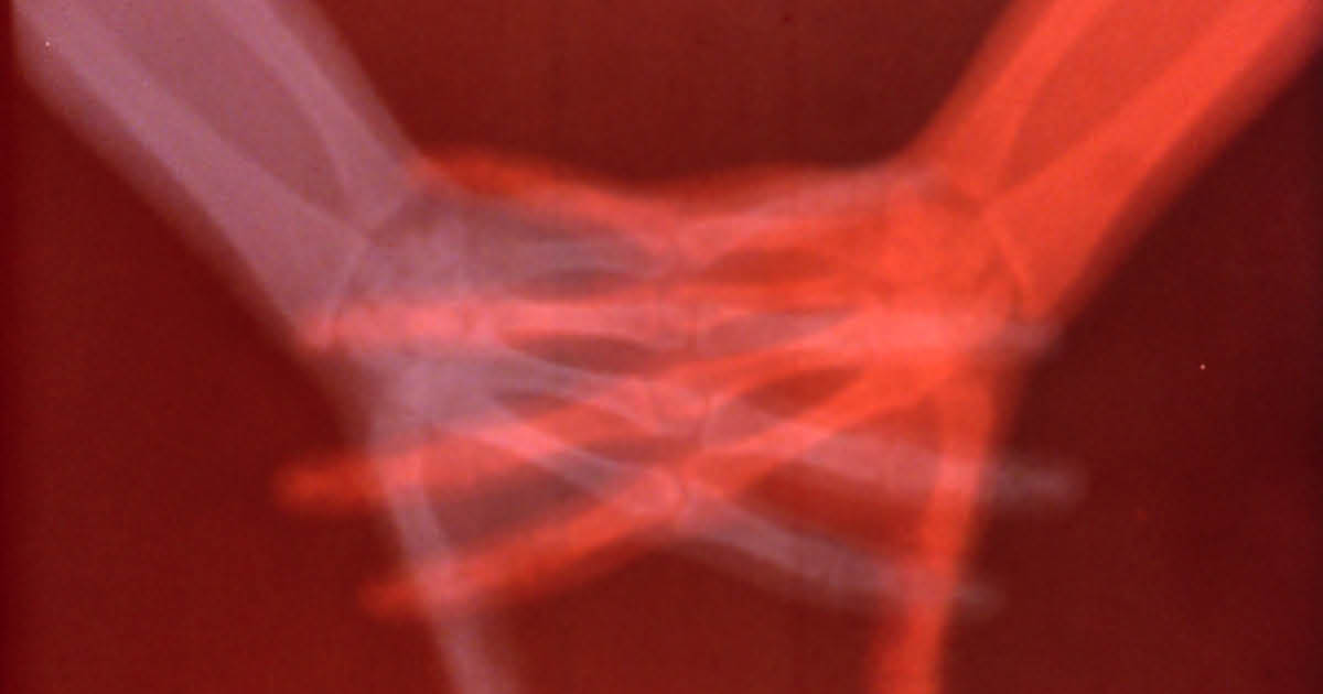 Exploring How Much Art, Technology, and the Body Intersect