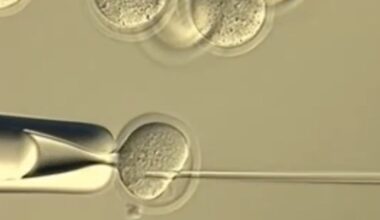 Scientists Tried to Clone Clones Forever. It Didn’t End Well