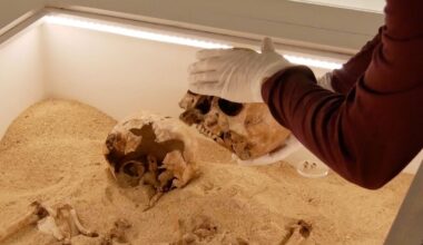 Rare Genetic Disease Discovered in Ancient Skeletal Embrace From The Ice Age : ScienceAlert