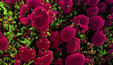 Viruses That Jump to Humans Don't Need Special Mutations, Study Finds : ScienceAlert