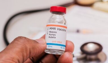 1st Measles Case Reported In DeKalb County